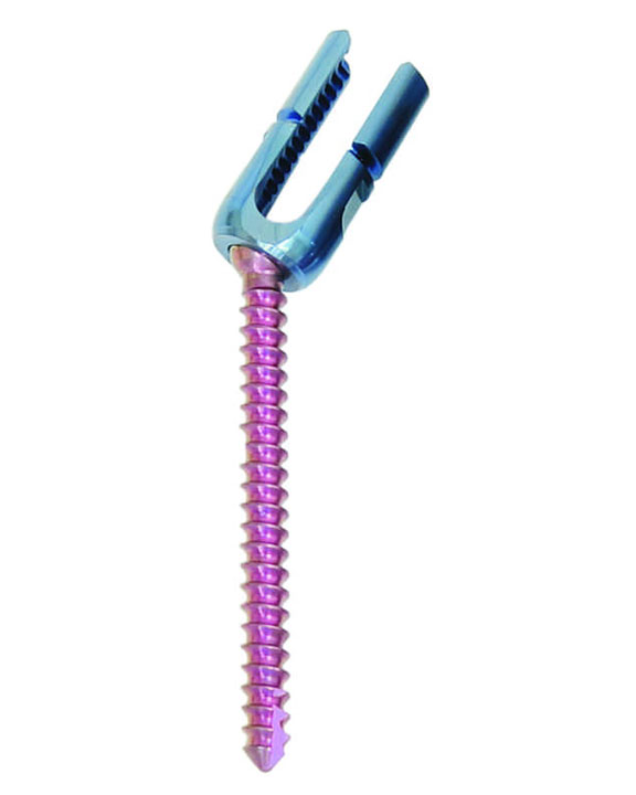 POLYAXIAL REDUCTION SCREWS (6.5mm)